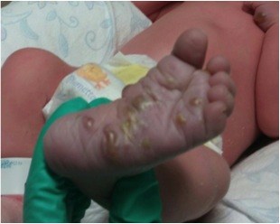 Incontri neonatologici tiberina